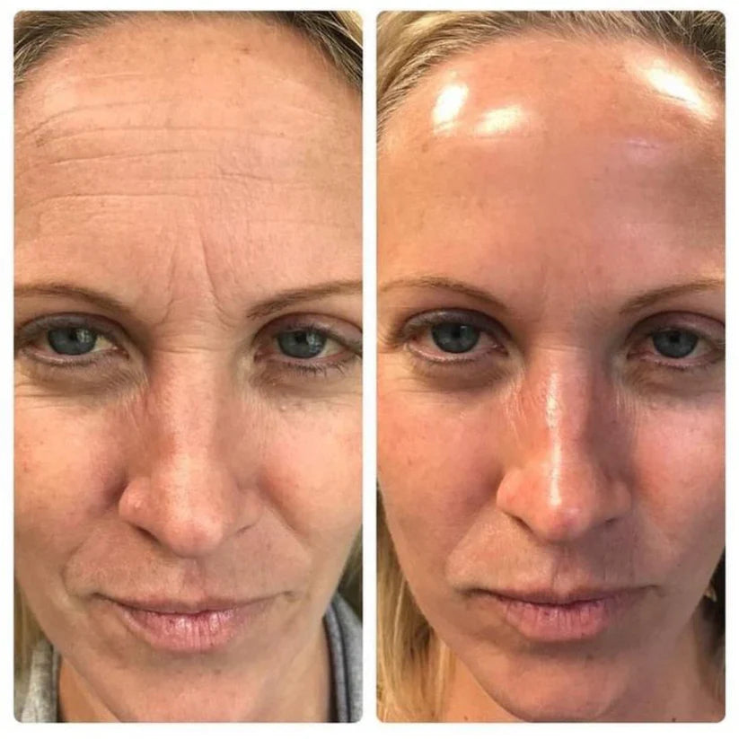 Munayra® Retinal Shot Coreano para Piel Renovada