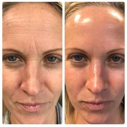 Munayra® Retinal Shot Coreano para Piel Renovada