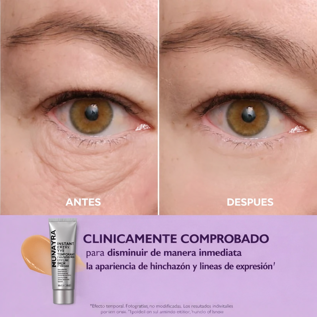Munayra® | Crema Anti-Ojeras
