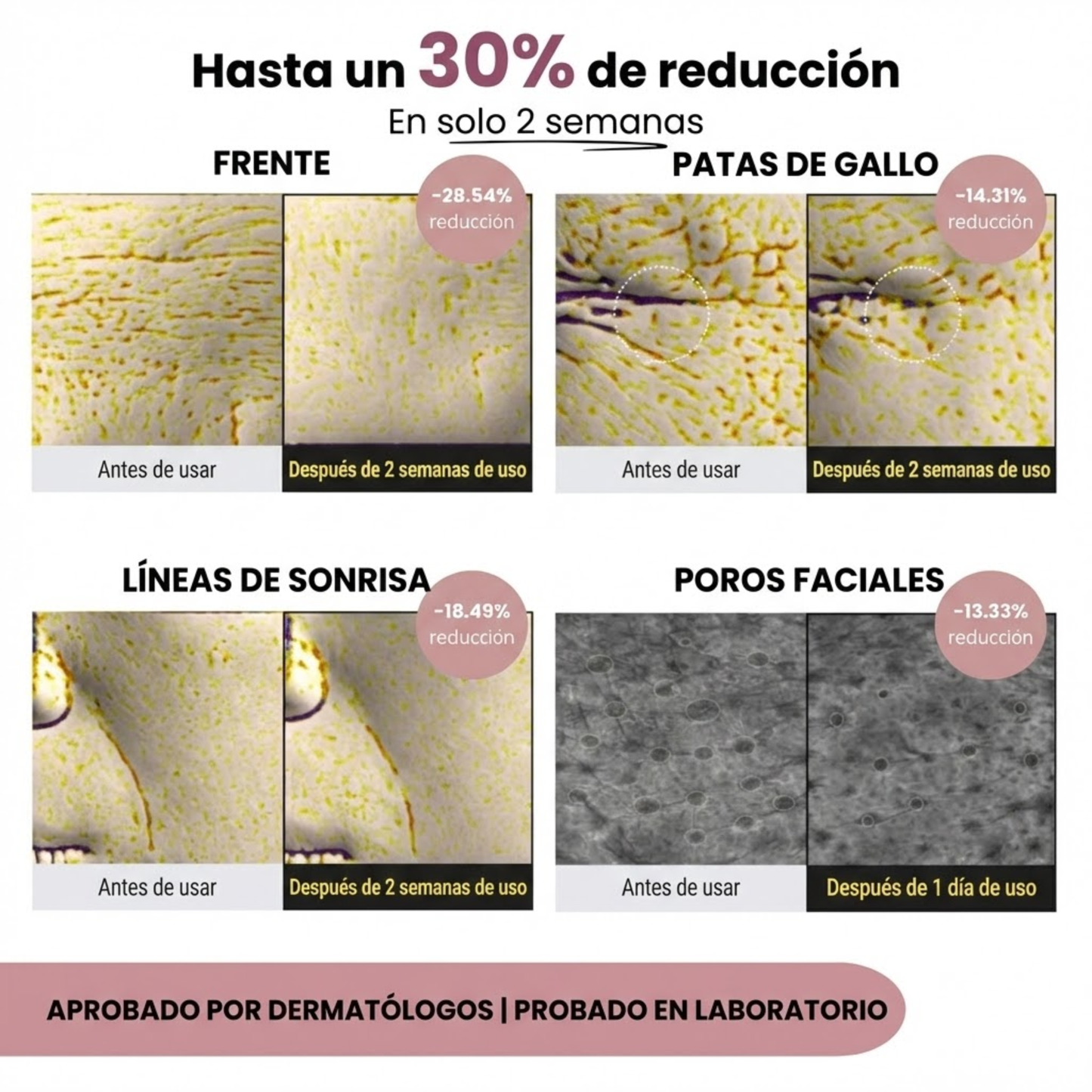 Bálsamo Multi Volumen de Calcio